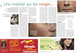 Une maladie qui fait rougir... : Wellness & Santé Magazine N°35, Hiver 2009/10 Une maladie qui fait rougir... : Wellness & Santé Magazine N°35, Hiver 2009/10